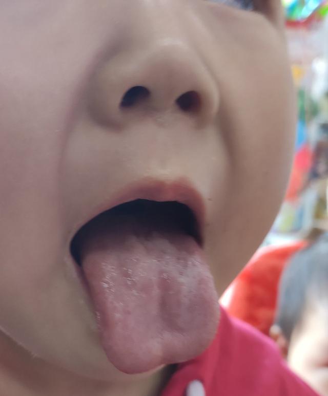[你的育儿经]你的脾胃健康吗？
