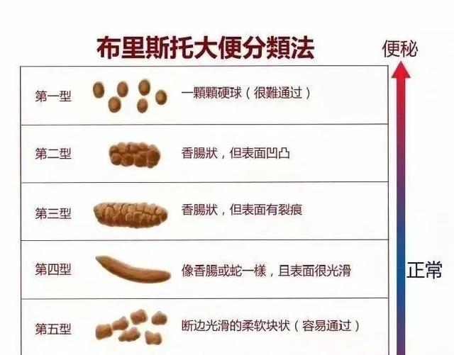 【实用】拉粑粑常遇便秘困扰？五个巧招助你解决每日晨起大事！