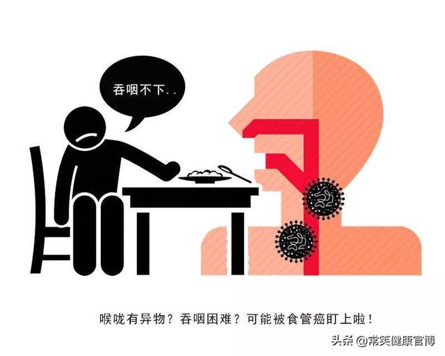 总觉得嗓子眼有东西，咳又咳不出来？医生：赶紧做胃镜