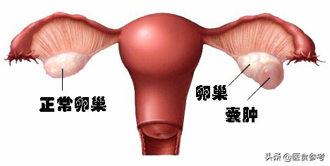 结节、息肉、囊肿、增生...哪个最可能癌变？这么多年疑惑终于解开了！