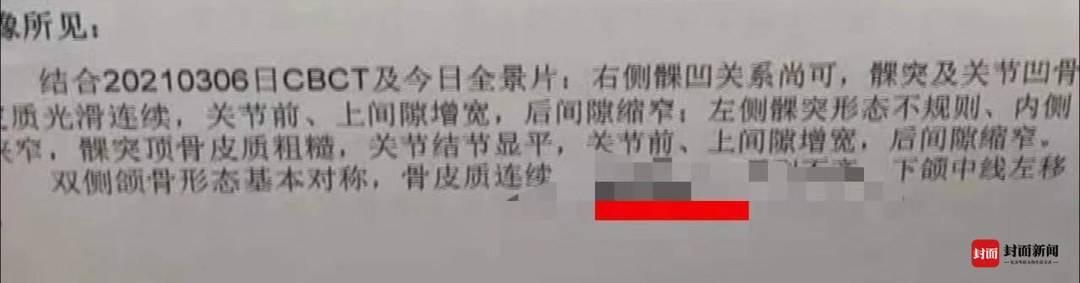 华西|坏牙不拔拔好牙？成都一女子找“华西特聘专家”拔牙出问题：系医生按照自身意愿拔牙