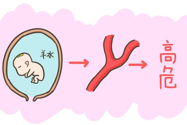 [你的育儿经]怀孕期间最怕羊水偏多、偏少还有浑浊，有关羊水的秘密你都知道吗