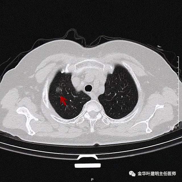 如此违反原则的手术方案设计，你支持吗？