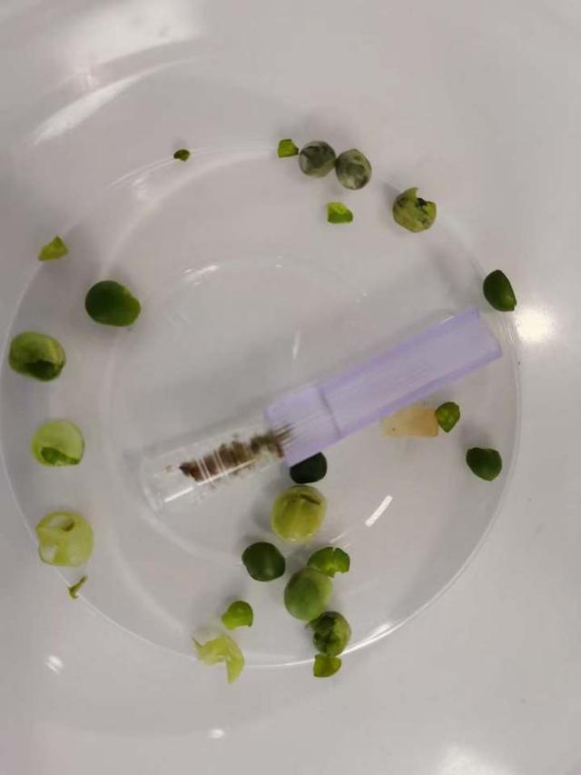 青豆|十几颗豆子差点要了老人的命！医生：发生误吸应该这样做