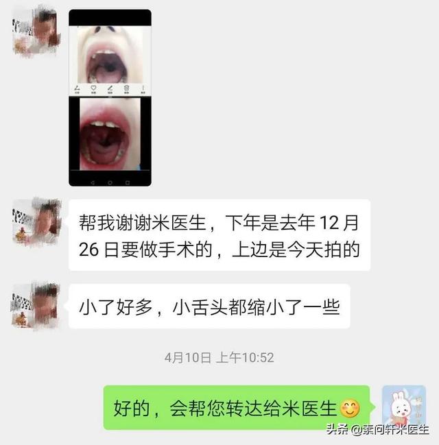 南浔的梦|米医生：腺样体手术后，为何孩子仍打呼、张嘴呼吸、严重黑眼圈？
