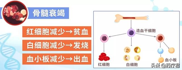 女子背部肩部总是有血印，以为是内衣勒得，结果病情比白血病还重