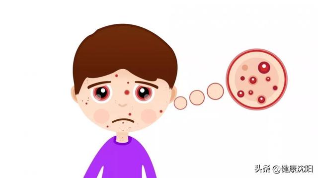 欢乐一家亲|健康科普堂 | 孩子发烧就是新冠肺炎吗？如何鉴别？