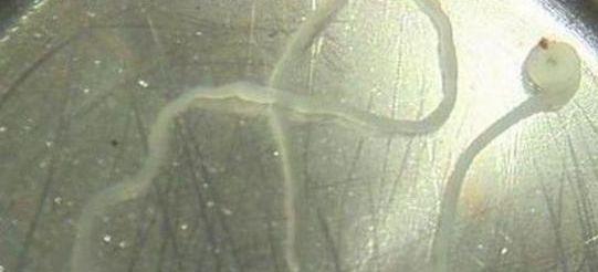 开心的笨小孩：8岁男童肝脏内长满了虫子？夏季这几种食物，家长尽量少给孩子吃！