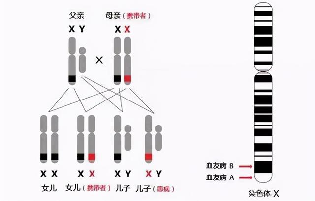 “重男轻女”的血友病可致残，幸亏遇到他们