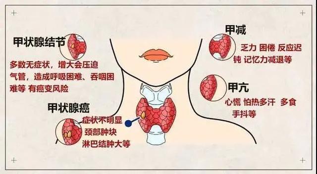 知识|下周三，虹口这里有一场关于甲状腺疾病的联合义诊