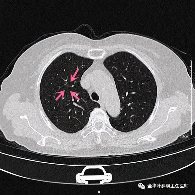 如此违反原则的手术方案设计，你支持吗？