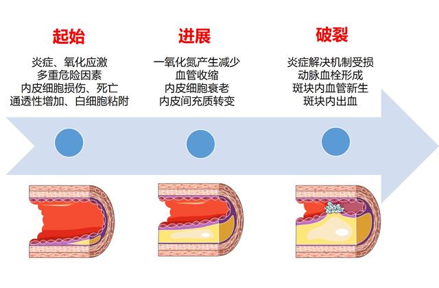 血管|揭秘“血管守护者”！科学家提出诊治高血压和糖尿病等新思路