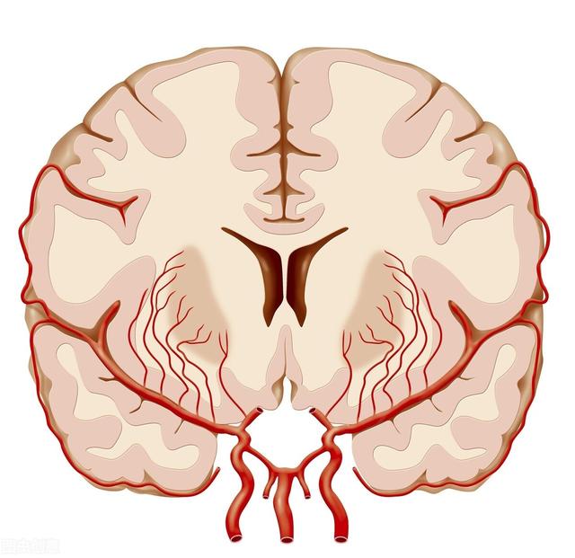 脑梗多半是&quot;吃&quot;出来的，老年人4种食物要&quot;忌口&quot;少给血管添堵