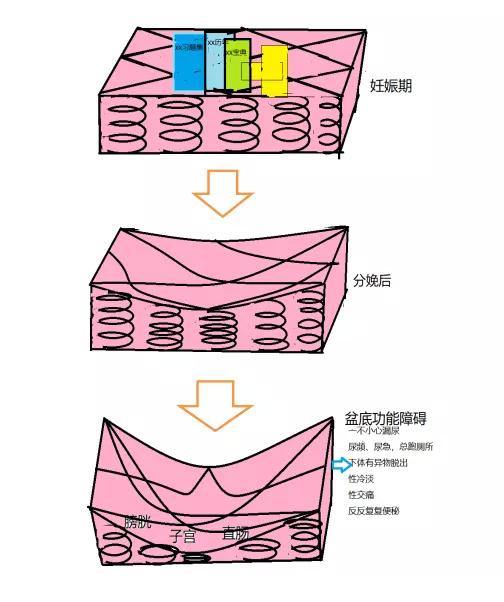 治疗|“笑尿了”不是玩笑话，可能是种病！金山这家医院为你解答→