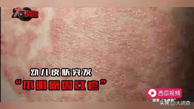 [你的育儿经]痛心！多名幼儿变“大头娃娃”，都跟喝了这种“奶粉”有关