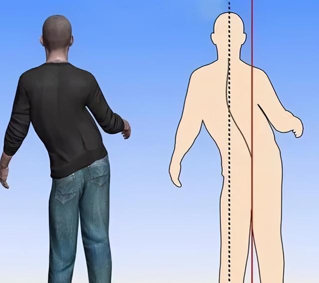 心梗要命，脑梗要瘫！血管堵住多少就要进行手术干预？