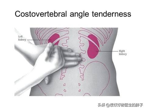 辟谣I腰疼就说明肾脏有问题？医生教您一个小查体，初步排除下吧