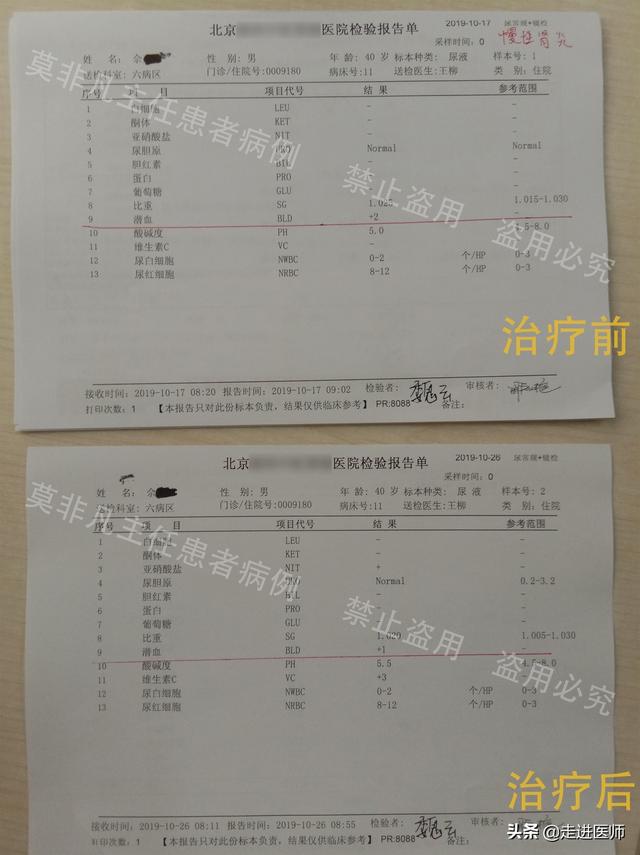 那些肾炎治疗不复发的人，有2个共同点，担心复发的人可了解一下