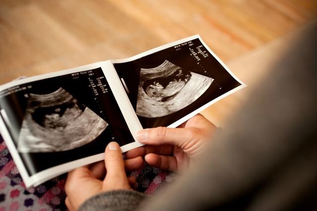 「你的育儿经」怀孕12周做b超为什么胎儿不动？有两种情况，附胎动时间和位置