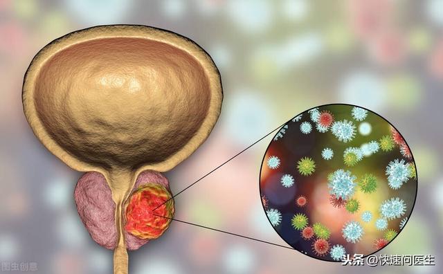 经常做这几件事，容易惹上前列腺炎，很多人还不自知