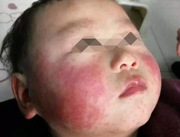 你的育儿经：这3种“水果”家长少给孩子吃，就连大人都要远离，尤其第2种