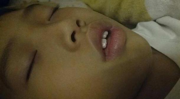 【超级宝妈】6岁女儿睡觉总张嘴，妈妈却使用胶带贴嘴，医生：真优秀