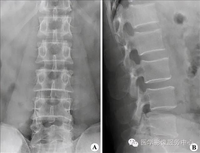 77种骨肌影像病例，助你诊断无忧