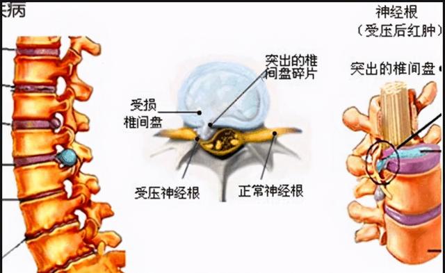 腰痛了该看哪个科？