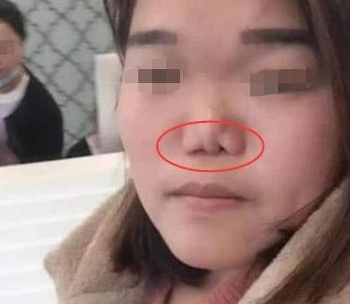 超级宝妈■孩子"挖鼻孔"不制止,这些"隐患"终成问题,坏结局谁也不想看
