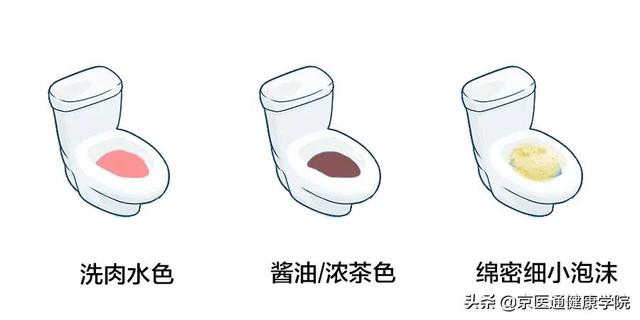 9个简单动作，在家就能做的「免费体检」