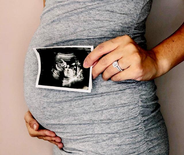 「你的育儿经」整个孕期做几次B超检查、分别多少周做？这有一份攻略，孕妈收藏