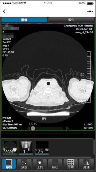 影像|告别纸袋+胶片，常州中医院开启“互联网+云影像”新时代