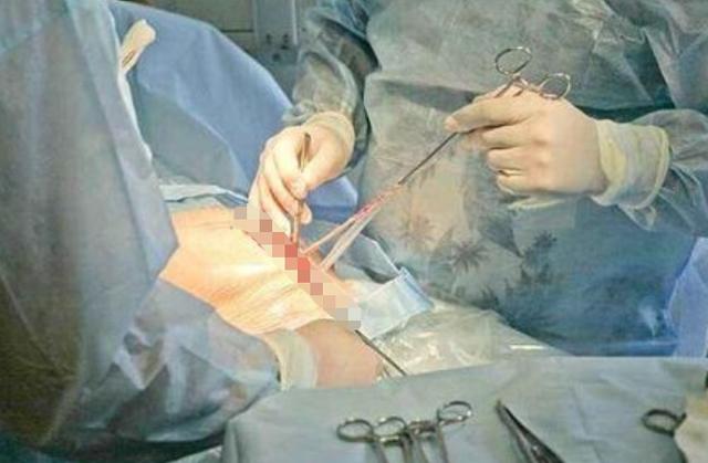 超级宝妈|产妇刚生完娃，肚子仍“鼓的”像怀孕8个月，医生手术后：对不起