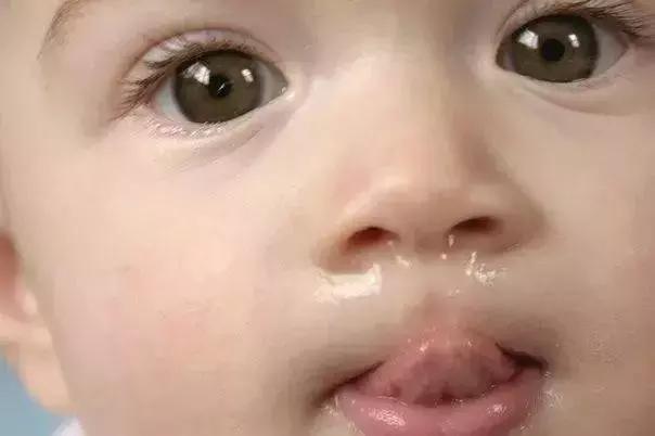 【你的育儿经】宝宝流鼻涕≠感冒，发现这种鼻涕要特别当心