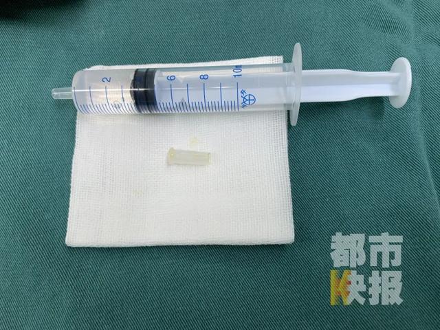 环球网■西安6岁女孩咳嗽发出“哨子声”，原来竟是受惊吓误吞了它