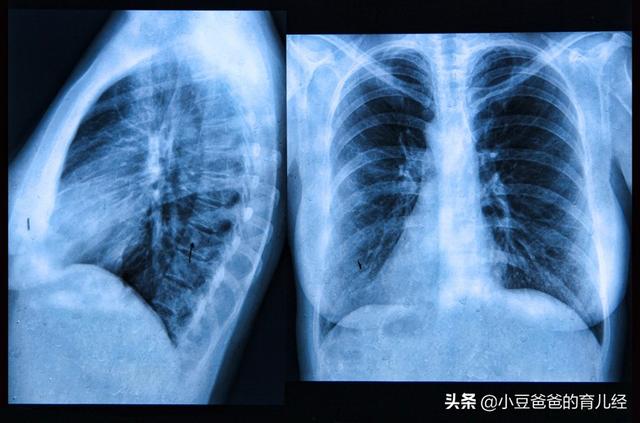 「你的育儿经」家里有这3样物品，妈妈赶紧给藏起来，小心宝宝误吞会有生命危险