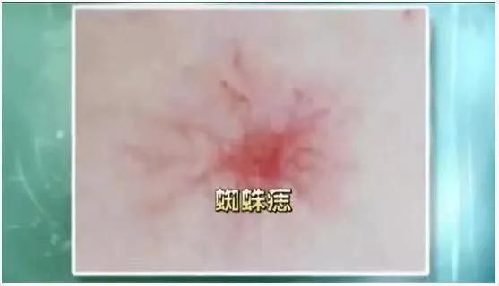 风险|在家就能做的全面“体检”，轻松自测身体