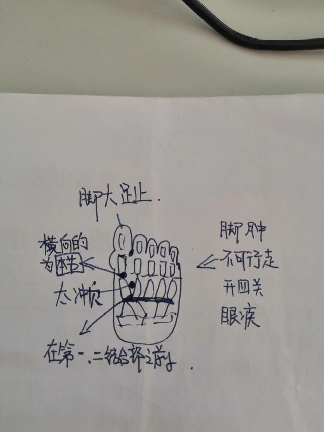 马丹阳十二穴(七)——太冲(偏瘫患者脚背伸不可大穴)