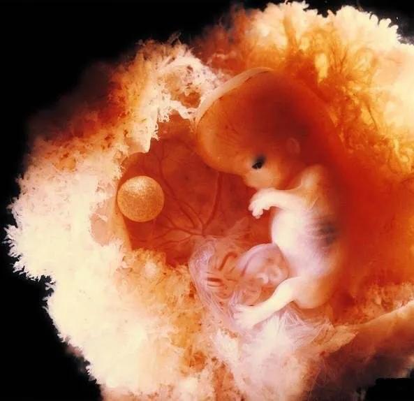 「你的育儿经」怀孕12周做b超为什么胎儿不动？有两种情况，附胎动时间和位置