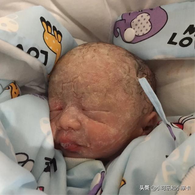 超级宝妈@早产的双胞胎兄弟，如何从干瘪小老头，逆袭为两个胖嘟嘟的小肉球