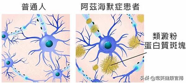 这9类疾病一旦患上，华佗在世都治不好你！千万不要被盯上