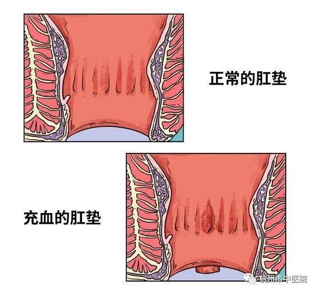 大二男生在内裤里垫卫生巾这个“隐疾”据说百分之九十的人都得过