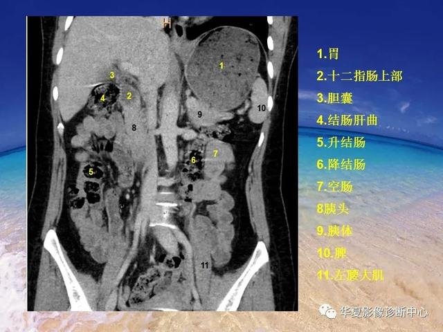 消化道穿孔的CT诊断