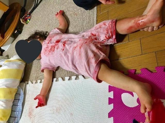 「超级宝妈」这些东西别让娃碰,妈妈下班后魂飞魄散,孩子满身是“血”倒屋内