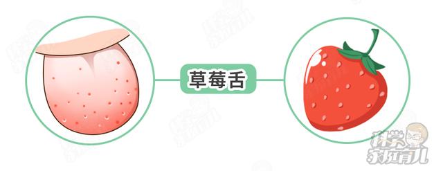 「你的育儿经」急！又一传染性极强的病正高发，8岁以下孩子要格外注意