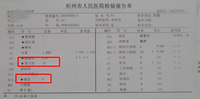 53岁王大爷看咳嗽，意外确诊肾病！2大肾病综合征症状，别忽视