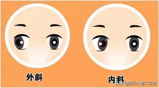 「超级宝妈」小儿先天斜视的治疗之路（一）