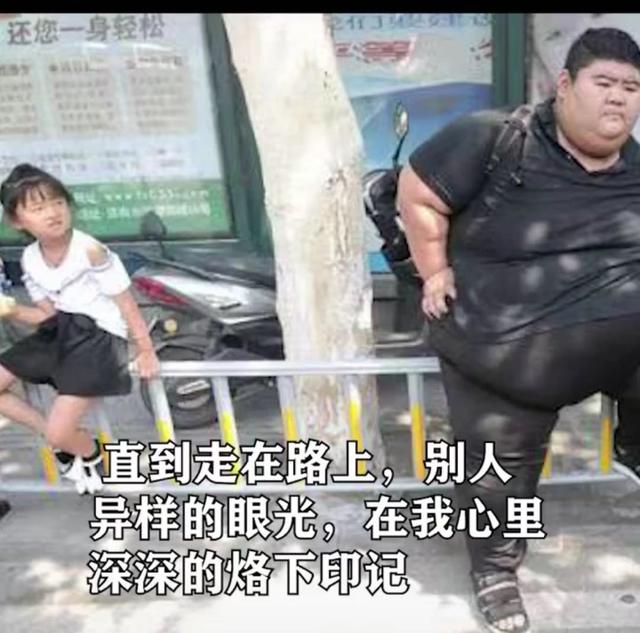 他是中国第一胖,为减肥切胃,并开始锻炼为爱减重