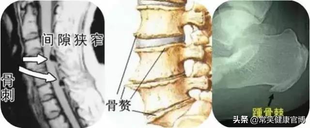 这9类疾病一旦患上，华佗在世都治不好你！千万不要被盯上