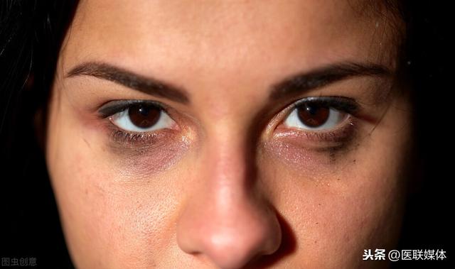 身上3处莫名发黑，可能是癌症要来了，可得留心观察一下